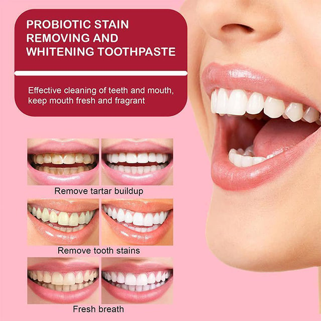 YAYASHI™ SP-6 Probiotic Whitening Toothpaste