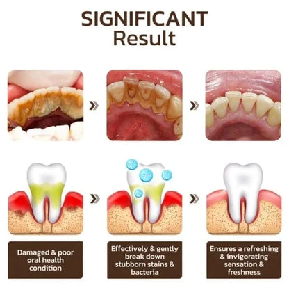 YAYASHI™ SP-6 Probiotic Whitening Toothpaste